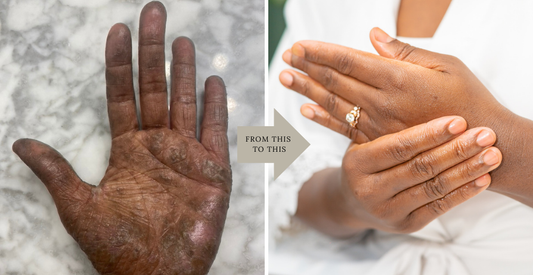 How I healed from my worst TSW symptoms in one year